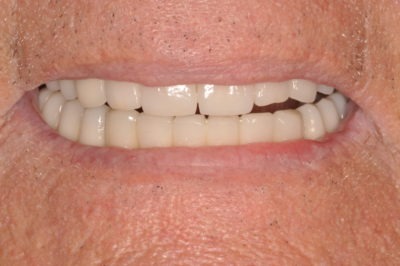 Close up of a man's mouth