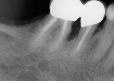 Dental x-ray