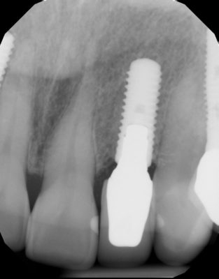 Dental x-ray