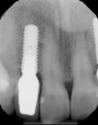 Dental x-ray