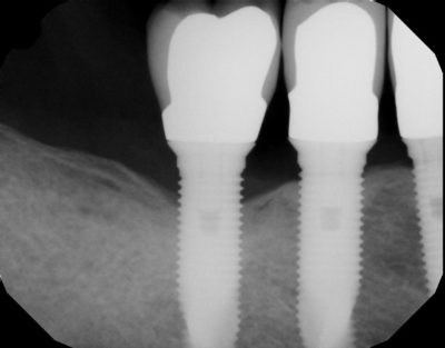 Dental x-ray