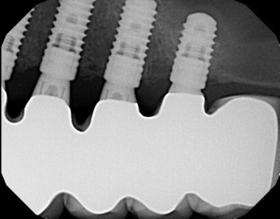 Dental x-ray