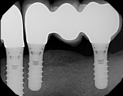 Dental x-ray