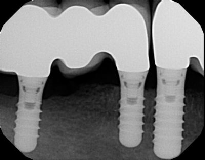 Dental x-ray