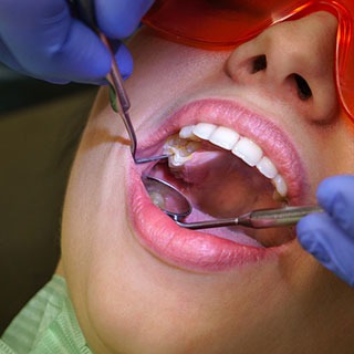 Close up image of a routine inspection of teeth and gums