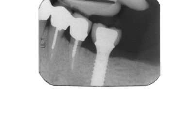 Dental x-ray