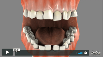 TeethToday Video Screenshot