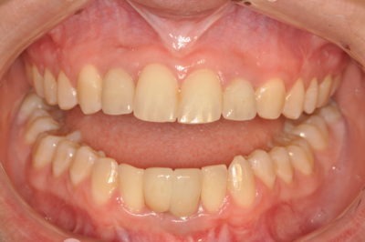 Close up of a healthy looking mouth and teeth