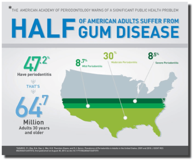 Infographic showing data that Half of American Adults Suffer from Gum Disease