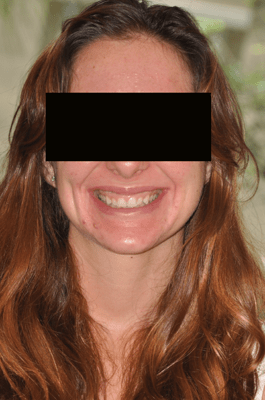 Photo of the face of a young white woman smiling