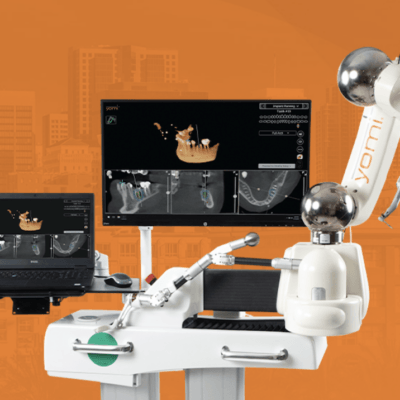 robotic assisted dental implant surgery